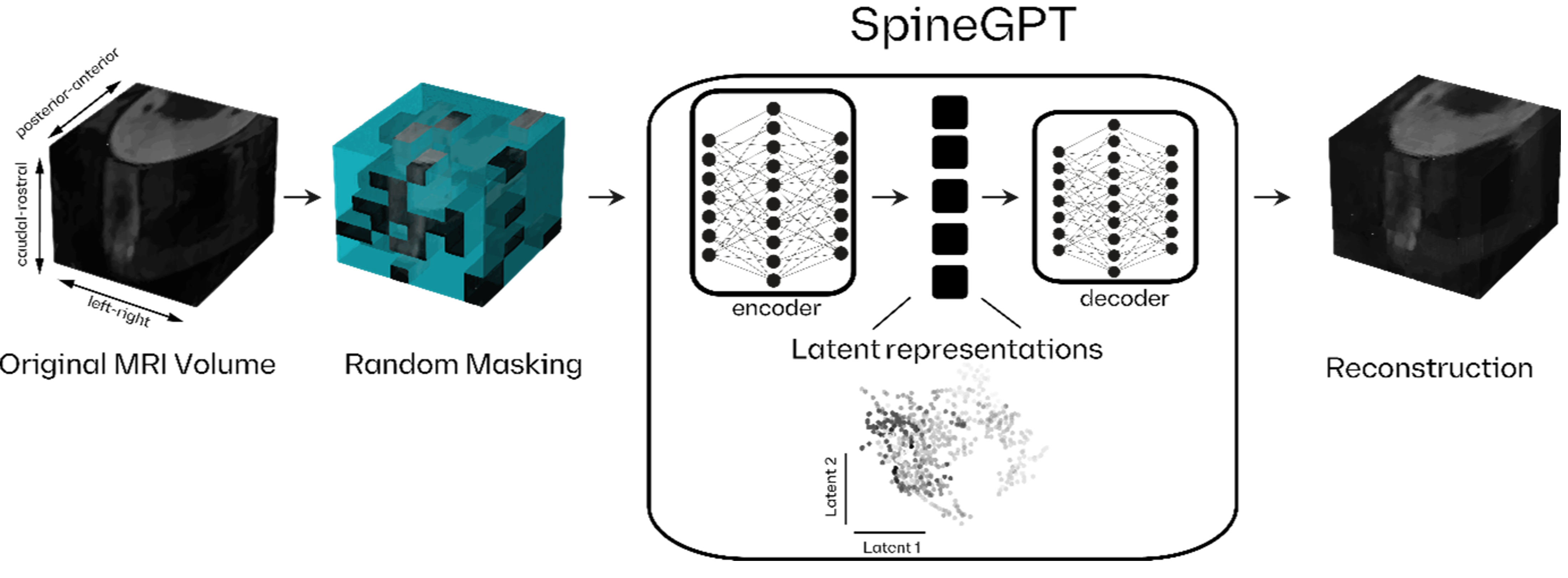 Figure 1 — SpineGPT self-supervised learning framework
